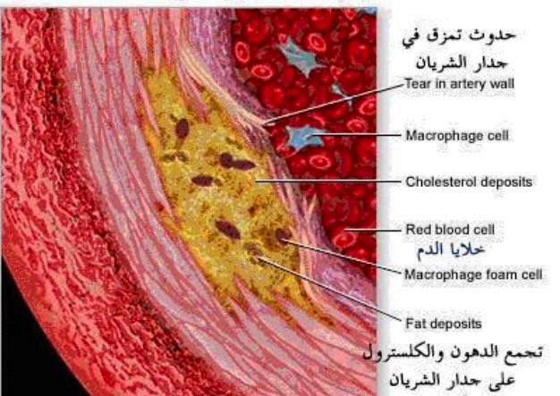 معلومات طبيه عامه - صفحة 5 8268.img_2135.jpg